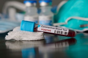 Ανησυχητική αύξηση κρουσμάτων κορωνοϊού στα Τρίκαλα - 23 νέες μολύνσεις